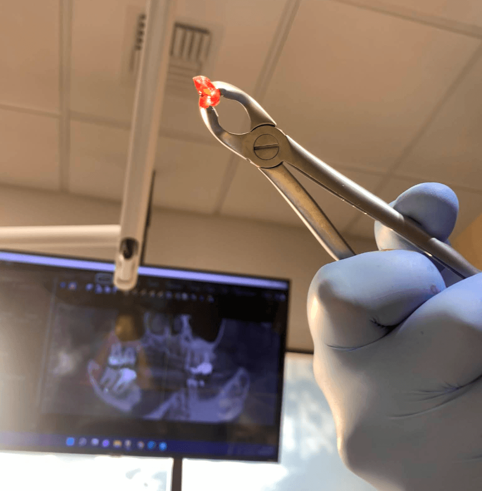 Joanna Shi — Emergency Oral Surgery results