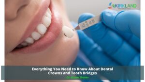Dental Crowns and tooth bridges