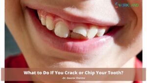 Chip or Crack Tooth