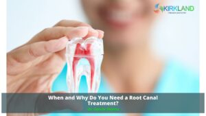 Root Canal Treatment