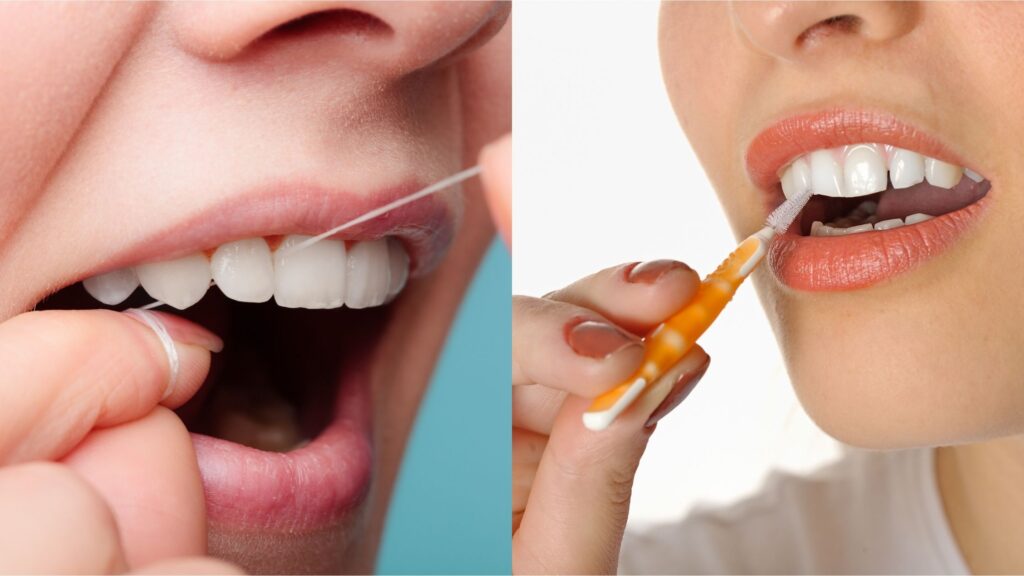 Which is better Flossing or Interdental Brushing? Kirkland Premier