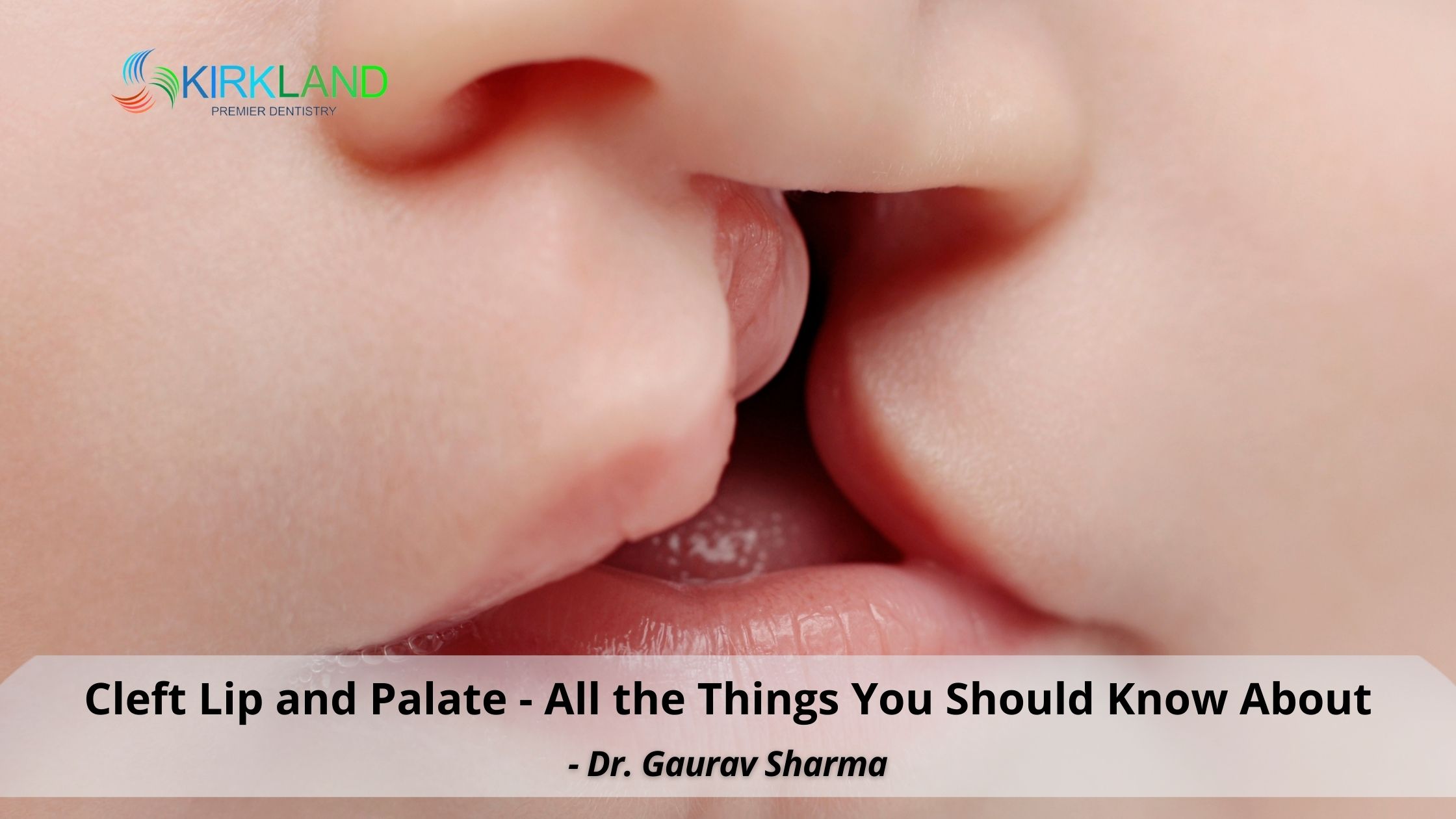 Cleft Lip and Palate All the Things You Should Know About Kirkland