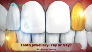 Tooth Jewellery