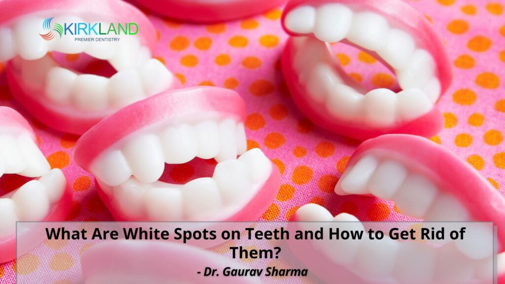 What Are White Spots on Teeth and How to Get Rid of Them? Kirkland