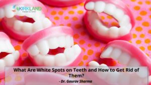 White Spots on Teeth