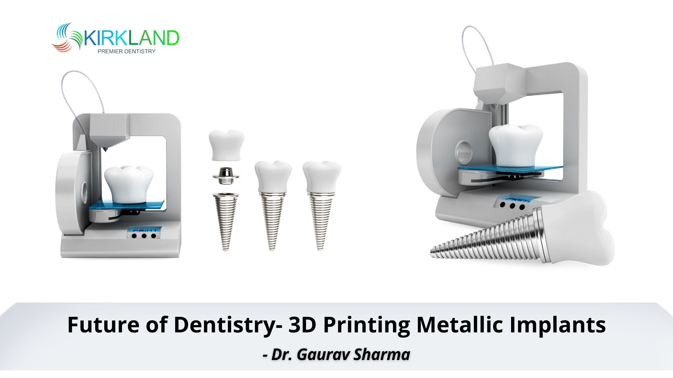 3D Printing Metallic Implants