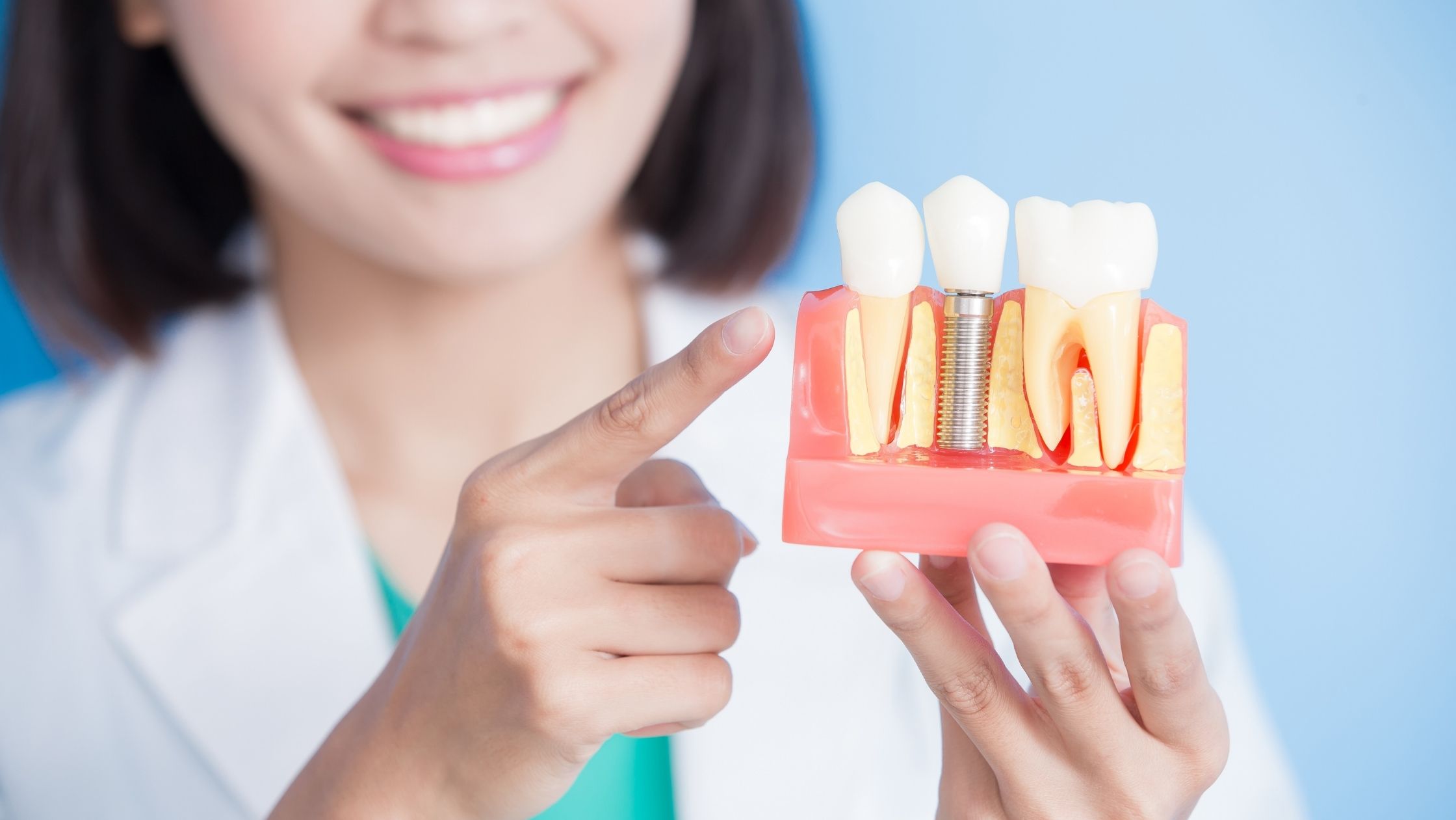 Are Dental Implants Safe? Kirkland Premier Dentistry