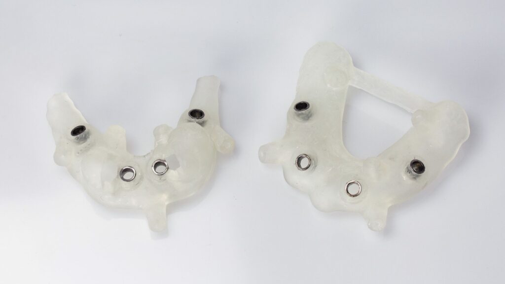 All On 4 Dental Implants Why Are They Better? Kirkland Premier Dentistry