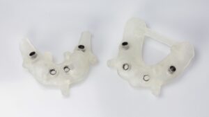 All on 4 Dental Implants