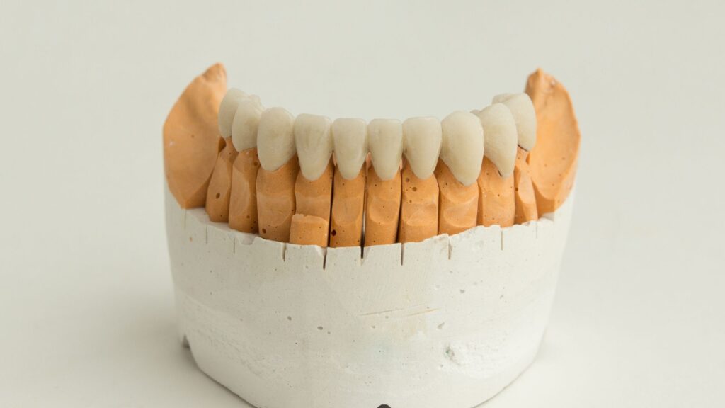 Temporary Crown vs. Permanent Crown What’s The Difference? Kirkland Premier Dentistry