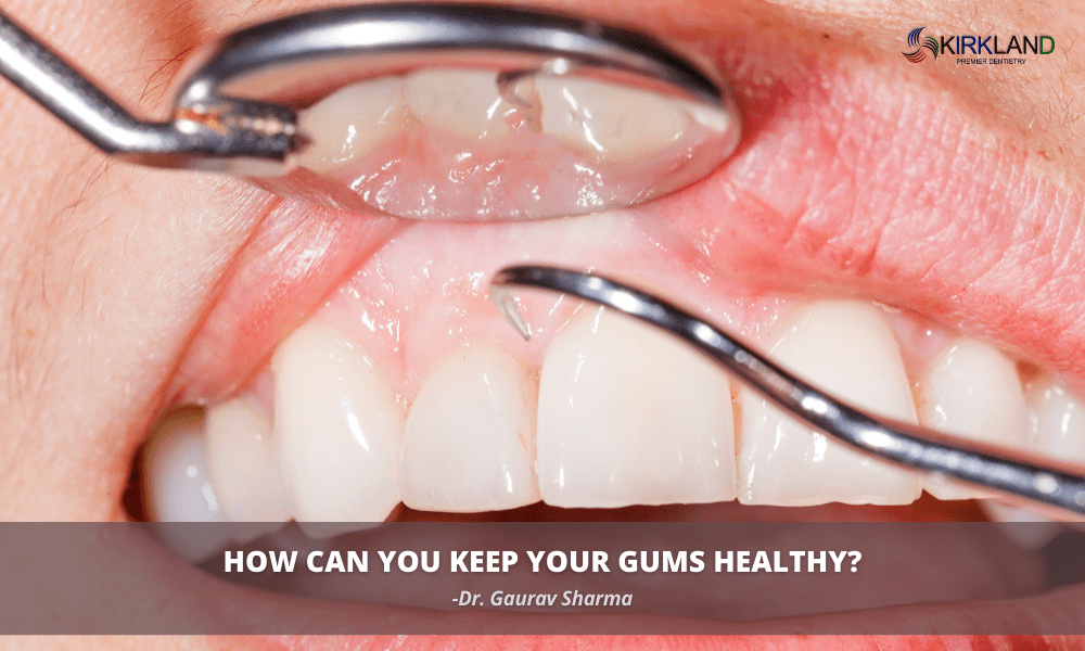How Can You Keep Your Gums Healthy? Kirkland Premier Dentistry