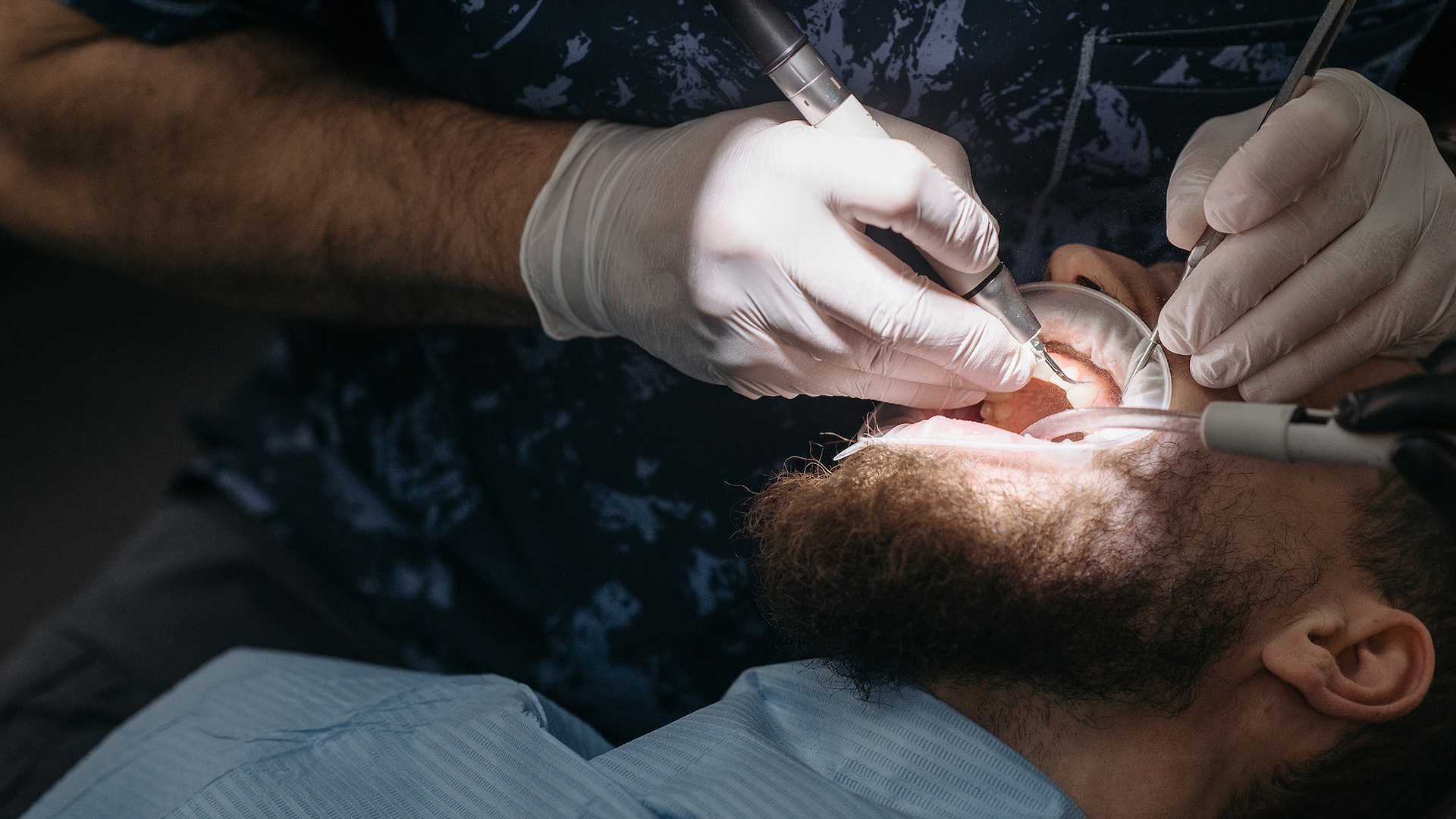 root canal kirland premier-dentist