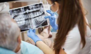 All About Bone Grafting in Kirkland