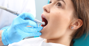 same day dental cleaning kirkland