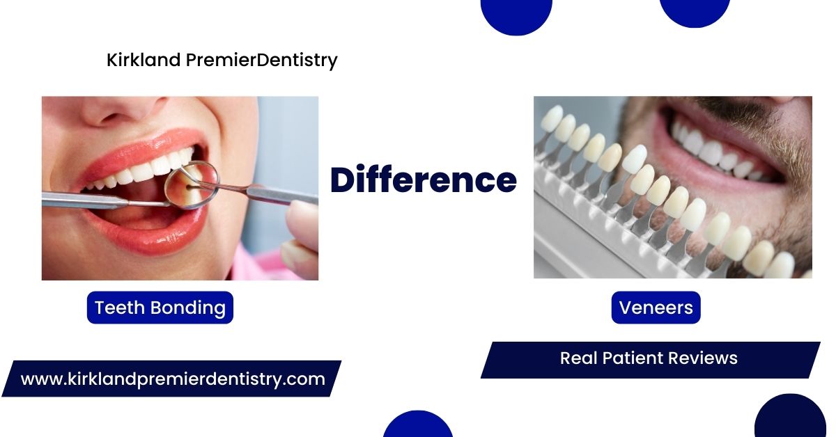 Teeth Bonding vs Veneers Real Patient Reviews & Expert Insights
