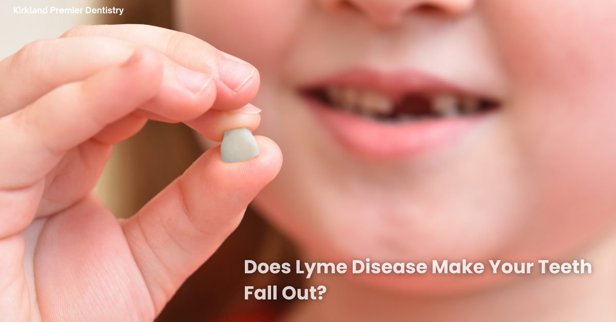 Does Lyme Disease Make Your Teeth Fall Out
