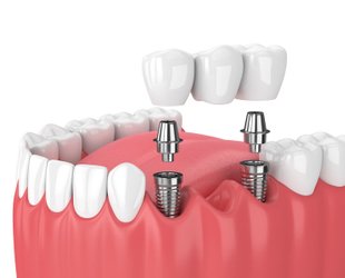 Service information image